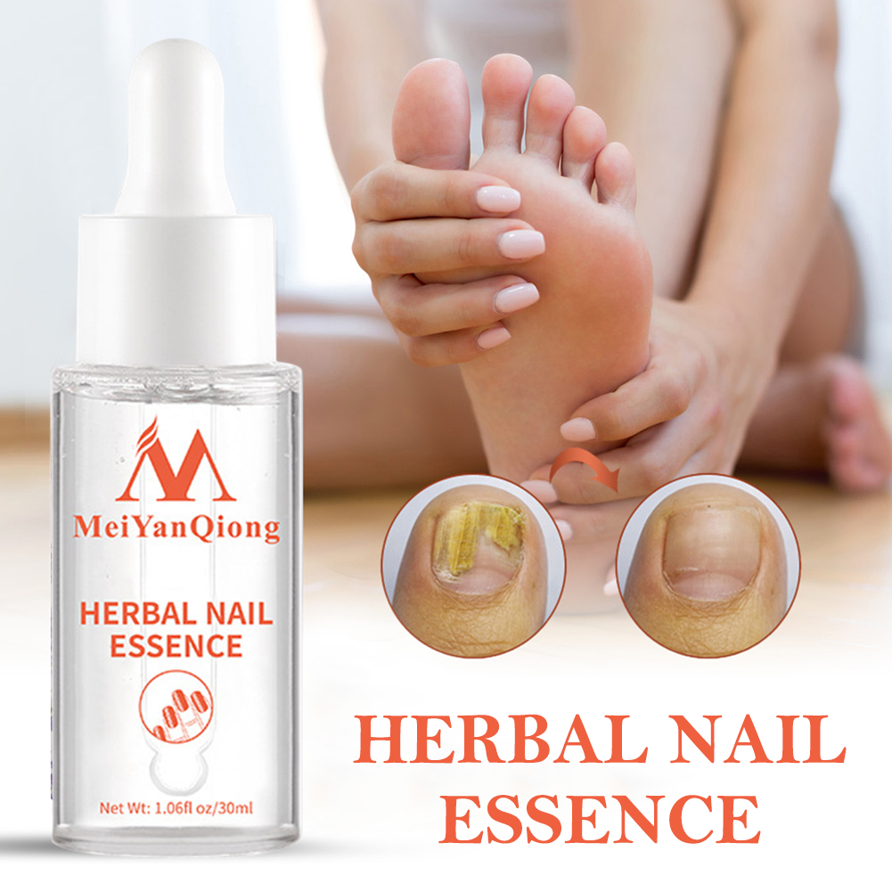 Gel de Soin des Pieds Anti-Myc - Mens Grooming Treatment avis et prix
